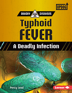 Cover Art for Typhoid Fever: A Deadly Infection